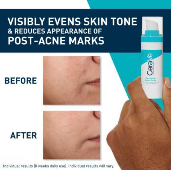 CeraVe Resurfacing Retinol Serum with Ceramides & Niacinamide for Blemish -Prone Skin 30ml